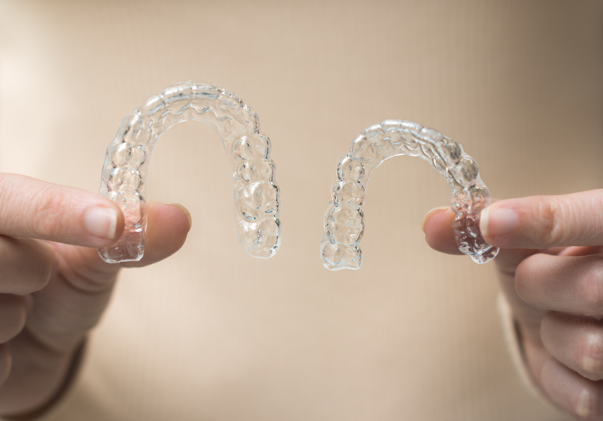 Pridobitev Invisalign zobne opornice